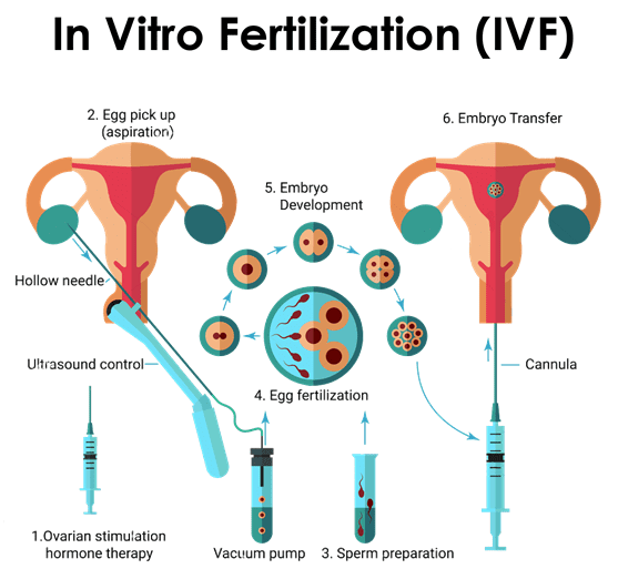 Will IVF Treatment Get Me Pregnant?