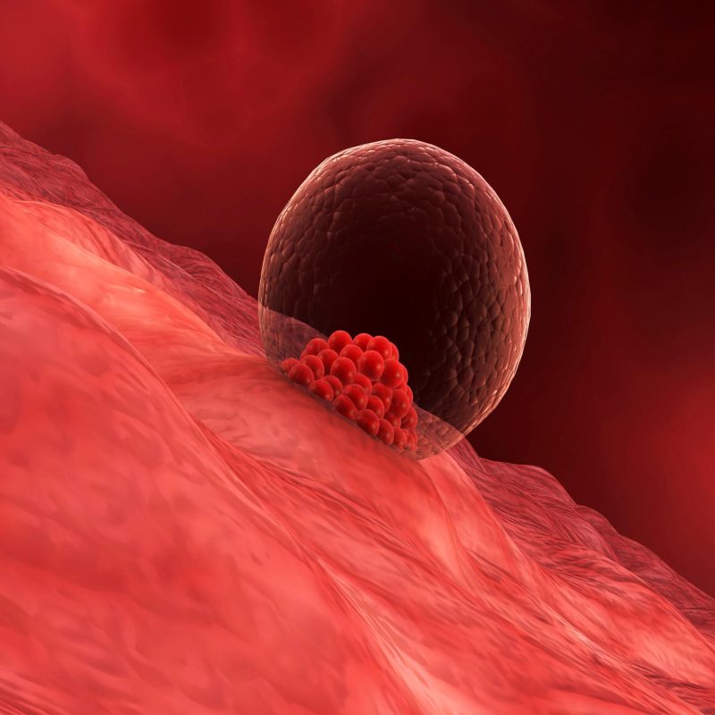 endometrial-receptivity-array